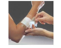 FILM ADESIVO IN POLIURETANO OPSITE FLEXIFIX IN ROTOLO TRASPARENTE IMPERMEABILE PER FISSAGGIO DI MEDICAZIONI E CATETERI LARGHEZZA 15 CM LUNGHEZZA 10 M 1 PEZZO - farmanauta.it